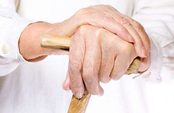 Arthrosis of the fingers of an elderly person