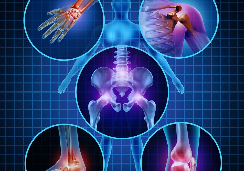 Joints that can be affected by arthrosis
