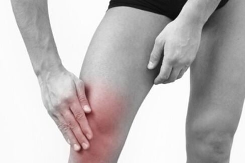 knee pain due to arthrosis picture 3